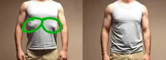 产后胸肋骨疼怎么回事科普丨产后容易被忽略的问题——肋骨外翻_https://www.jmylbn.com_新闻资讯_第13张