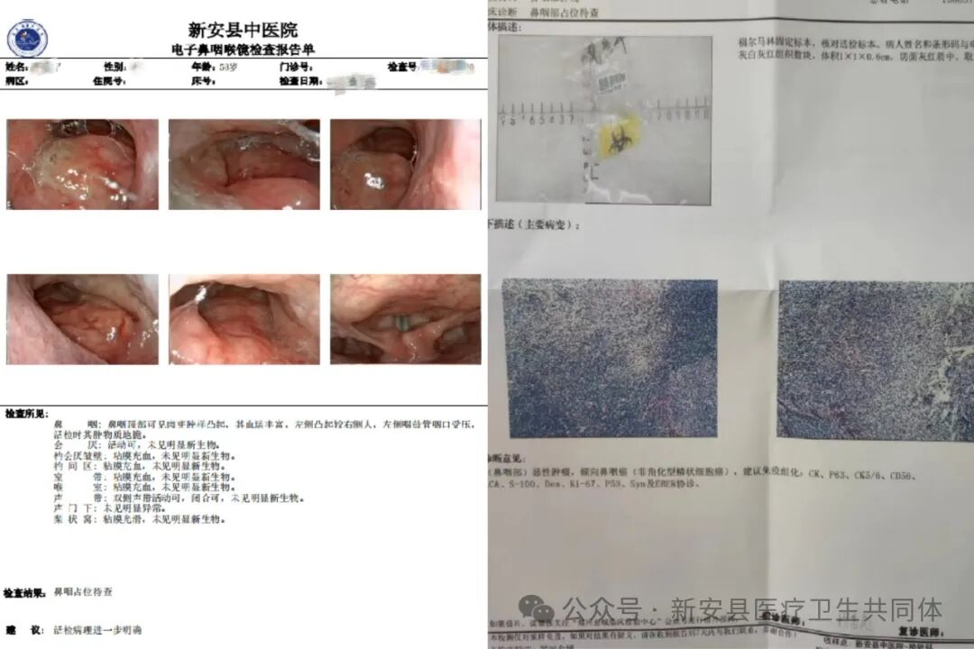 什么是电子鼻咽镜耳鼻喉科的小镜子——电子鼻咽喉镜_https://www.jmylbn.com_新闻资讯_第2张