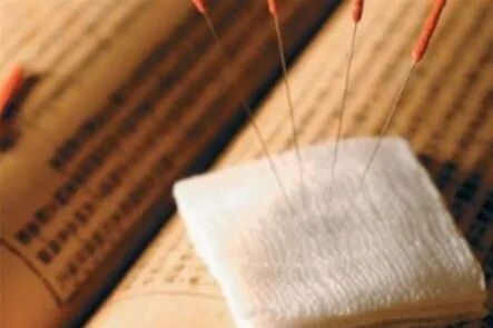 导什么针什么作用“药之不达，唯针可到”中医针灸的功效你知多少？_https://www.jmylbn.com_新闻资讯_第15张