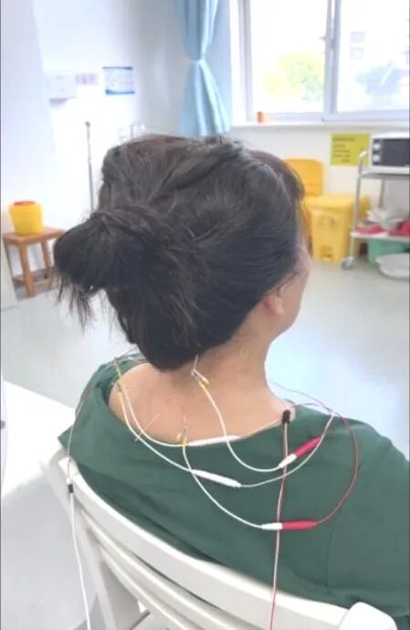 导什么针什么作用“药之不达，唯针可到”中医针灸的功效你知多少？_https://www.jmylbn.com_新闻资讯_第16张