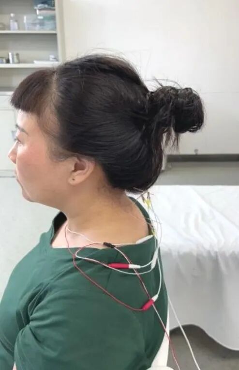 导什么针什么作用“药之不达，唯针可到”中医针灸的功效你知多少？_https://www.jmylbn.com_新闻资讯_第17张