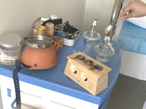 导什么针什么作用“药之不达，唯针可到”中医针灸的功效你知多少？_https://www.jmylbn.com_新闻资讯_第22张