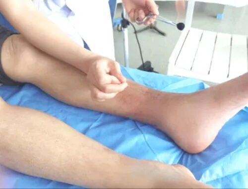 导什么针什么作用“药之不达，唯针可到”中医针灸的功效你知多少？_https://www.jmylbn.com_新闻资讯_第19张