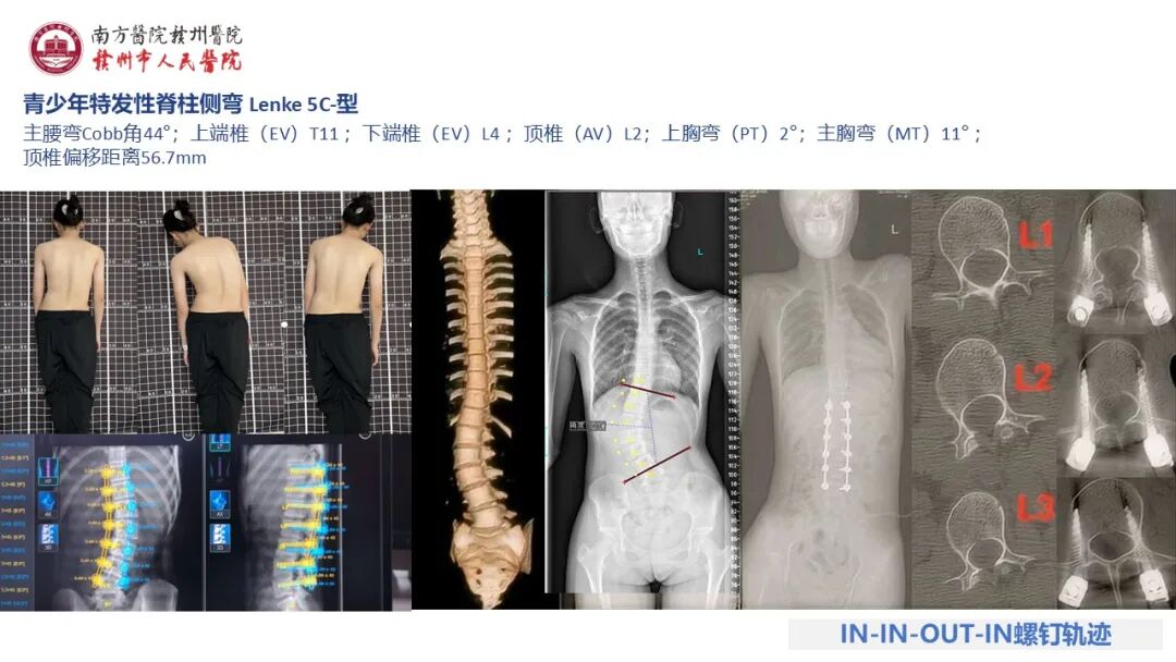 《脊智领航》|