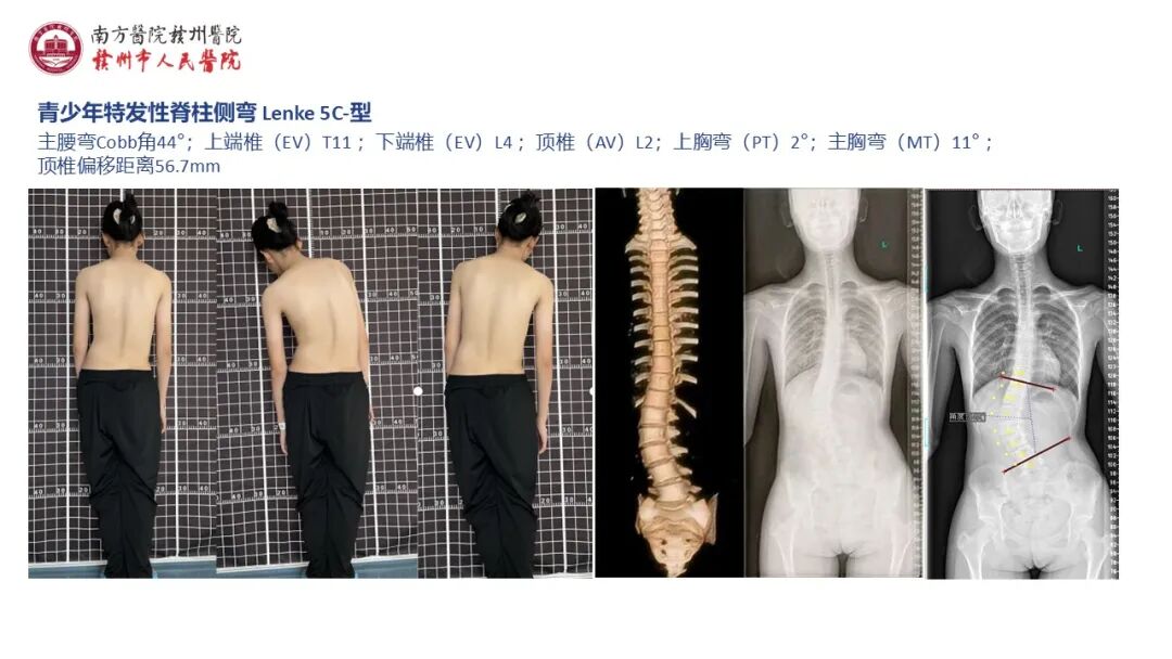 《脊智领航》|