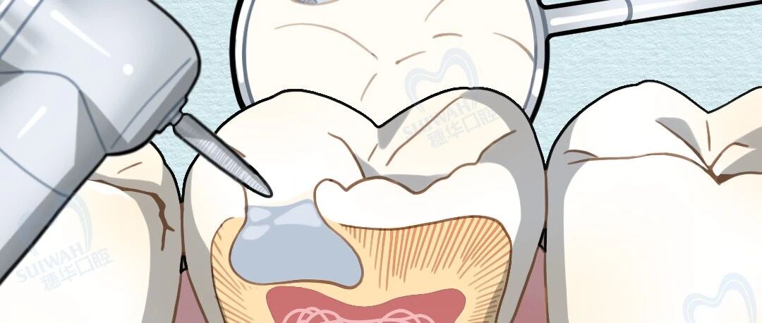 cover_image