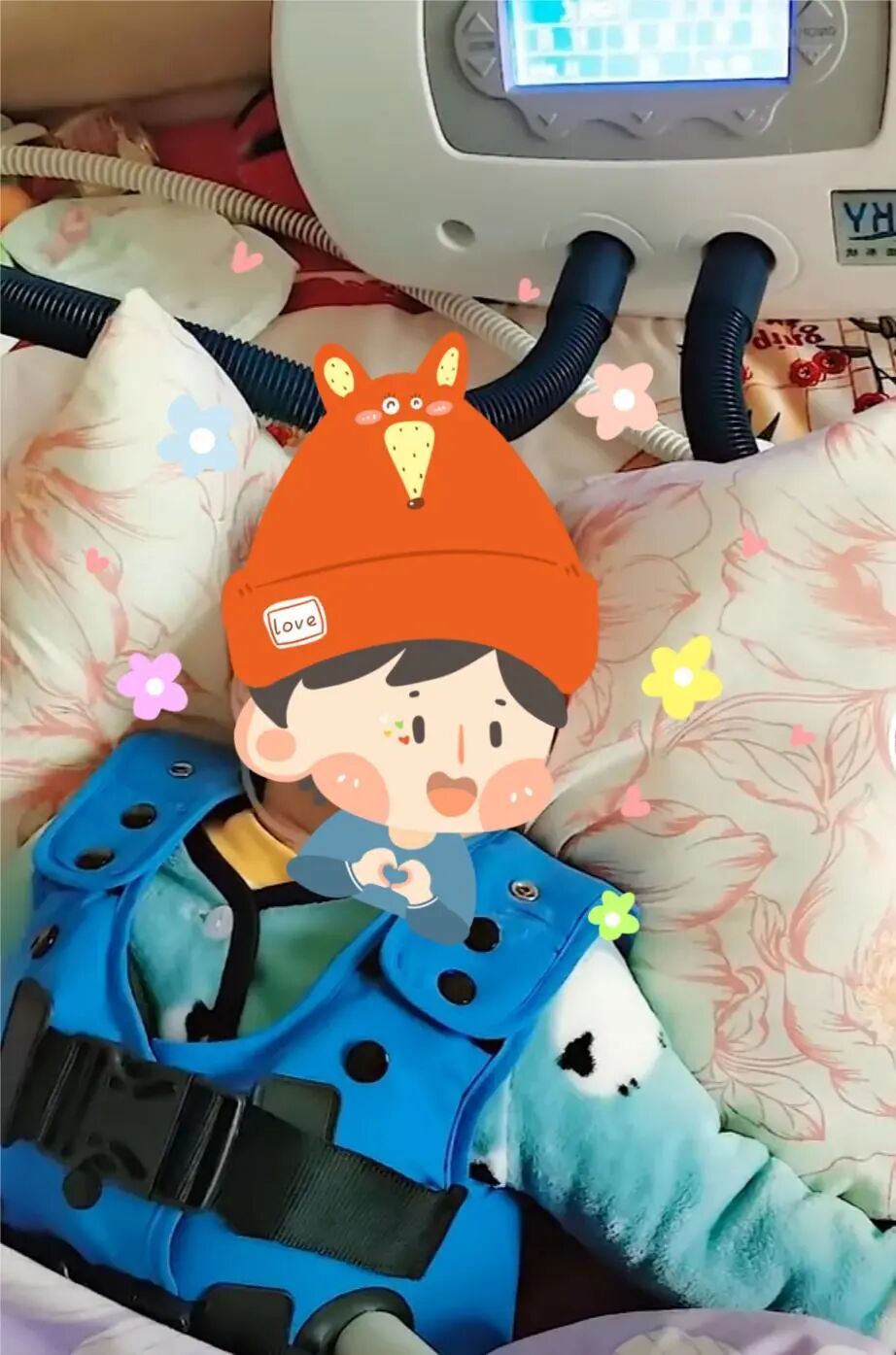 为什么要电动吸痰排痰设备有哪些？为什么推荐使用咳痰机？看完这个就懂了！_https://www.jmylbn.com_新闻资讯_第26张