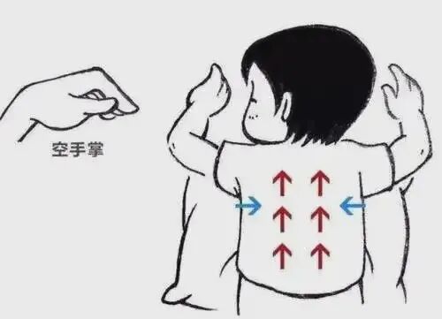 为什么要电动吸痰排痰设备有哪些？为什么推荐使用咳痰机？看完这个就懂了！_https://www.jmylbn.com_新闻资讯_第13张