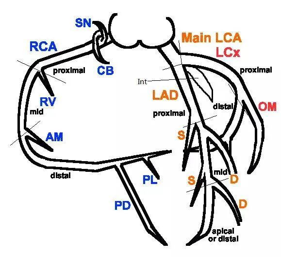 冠状动脉造影？没那么难，这样教你弄懂！