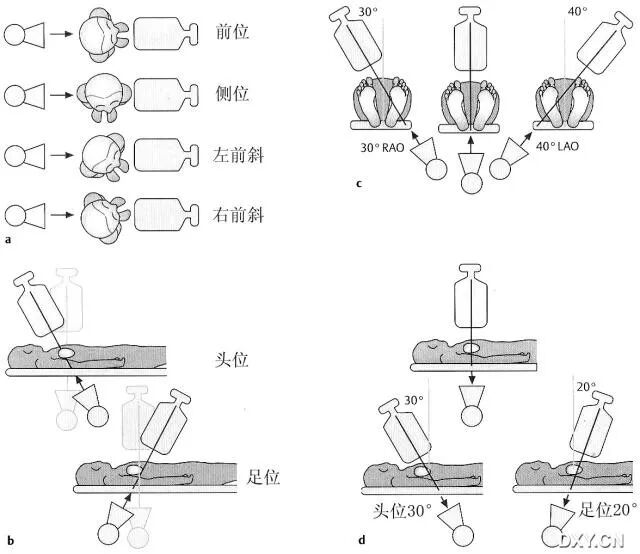 冠状动脉造影？没那么难，这样教你弄懂！