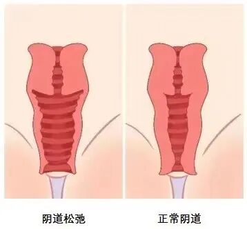二氧化碳(co2)激光治疗是什么革新妇科治疗领域：CO2点阵激光技术引领无痛高效康复新时代_https://www.jmylbn.com_新闻资讯_第12张