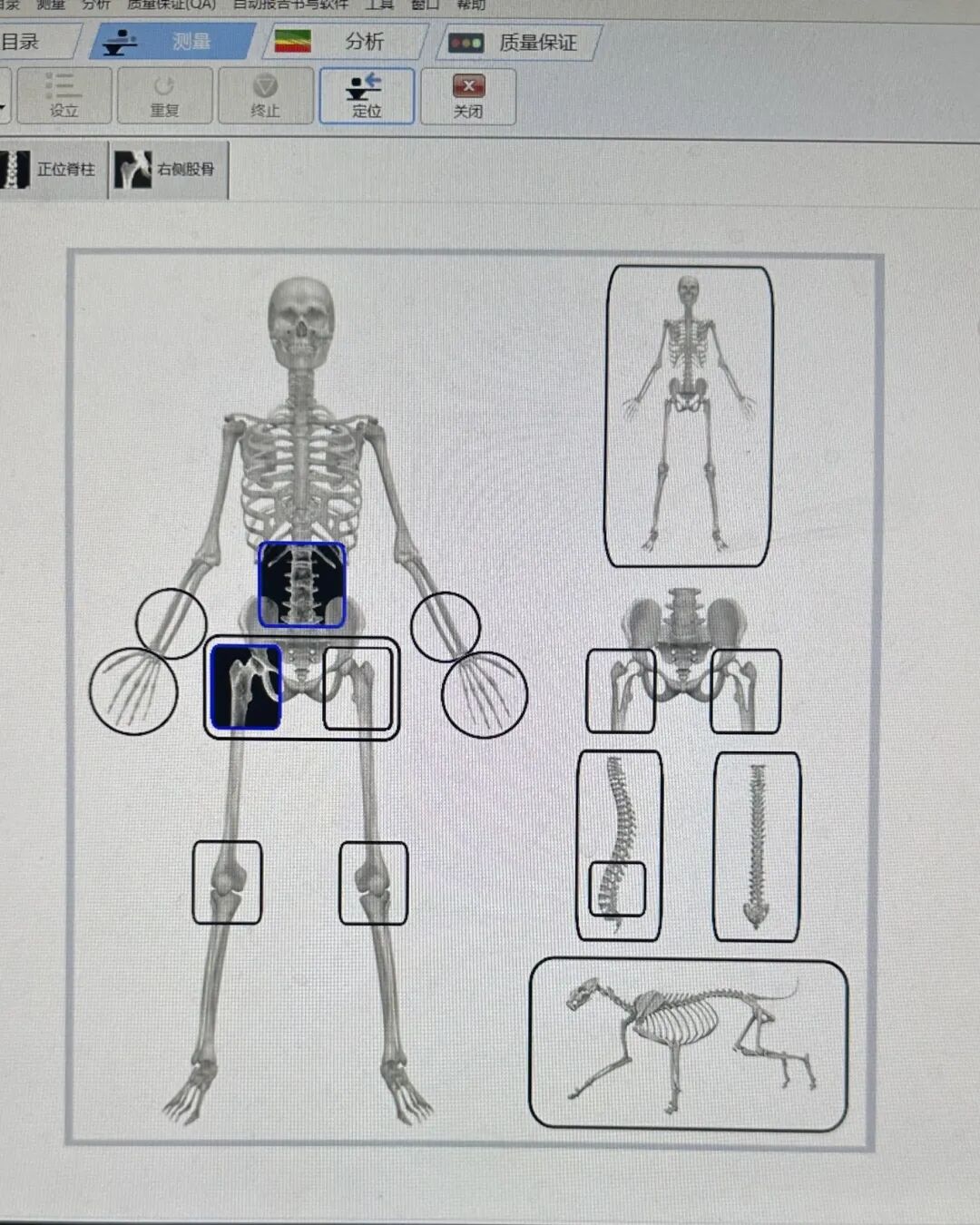 双能x骨密度检测仪为什么非得输入体重身高健康管理新利器：双能X线骨密度检测，助力骨骼与身体成分全面评估_https://www.jmylbn.com_新闻资讯_第2张