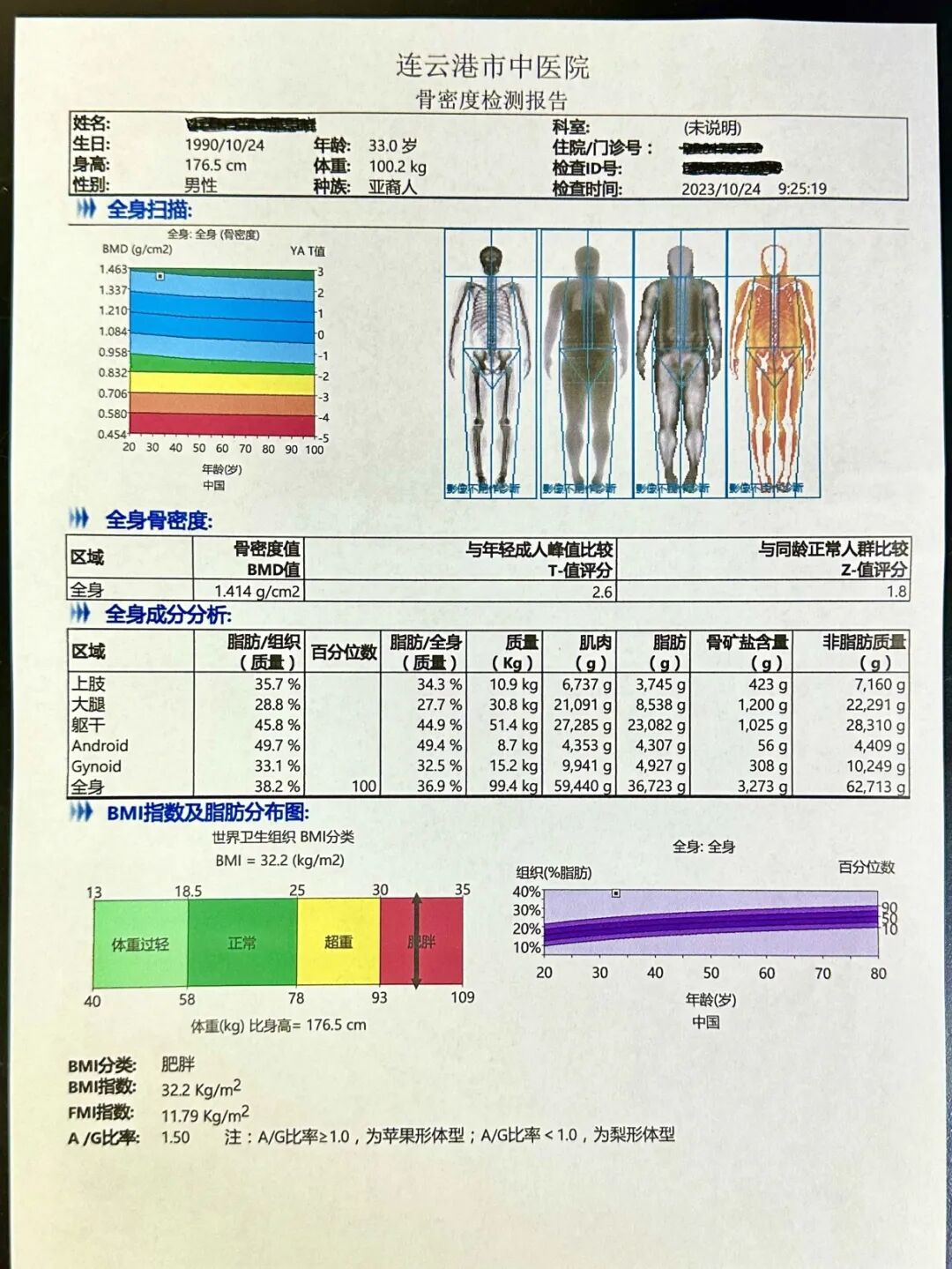 双能x骨密度检测仪为什么非得输入体重身高健康管理新利器：双能X线骨密度检测，助力骨骼与身体成分全面评估_https://www.jmylbn.com_新闻资讯_第4张
