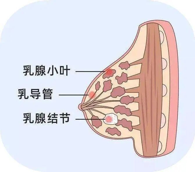 乳腺定位针怎么放新技术上线 ｜ 让早期乳腺癌无处遁形——超声引导下导丝定位“捕捉”乳腺小结节_https://www.jmylbn.com_新闻资讯_第3张