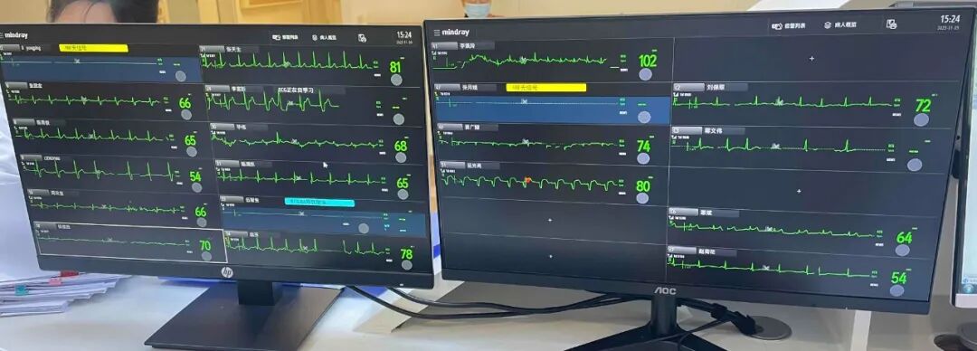 心电遥测怎么戴心内小知识 ︳动态心电图和遥测心电监护的区别_https://www.jmylbn.com_新闻资讯_第4张