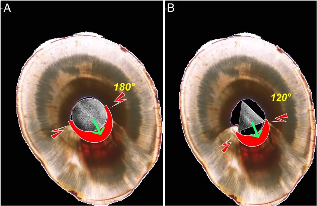 体疗器械分为什么使用脊髓针技术取出分离器械的临床疗效：30年临床经验的回顾性研究_https://www.jmylbn.com_新闻资讯_第8张
