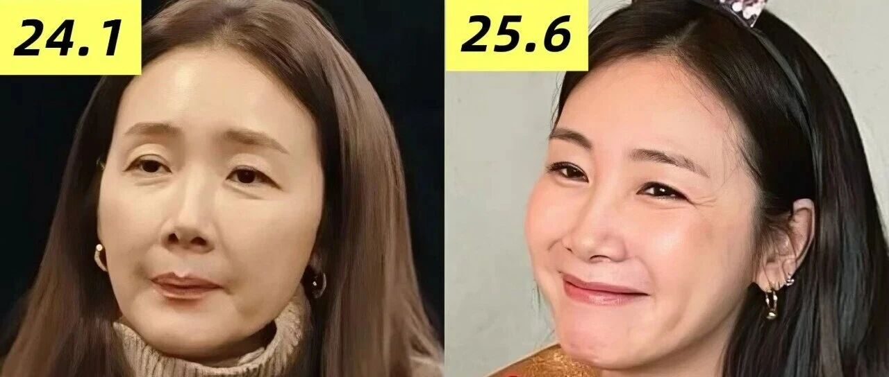 崔智友终于把60岁的脸整回50岁!但并不算成功回春…