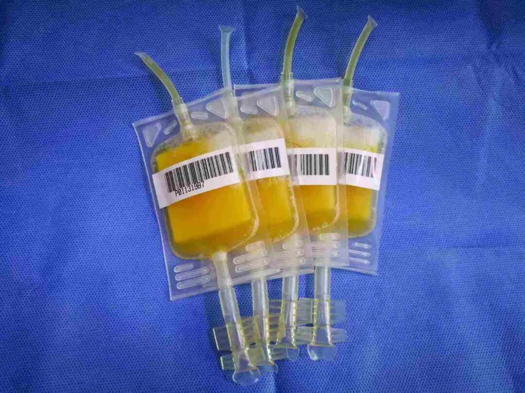 血小板660有什么危害盛夏关节病高发：富血小板血浆疗法来帮忙_https://www.jmylbn.com_新闻资讯_第13张