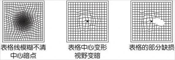 相机afc是什么意思【科普】我们的眼睛就是我们最好的“相机”，要好好珍惜_https://www.jmylbn.com_新闻资讯_第5张