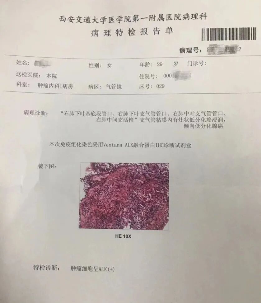 乳腺cr是什么29岁女性，肺癌转移到乳腺、后续转移全身……历经绝望后换药，仅3个月我CR了！_https://www.jmylbn.com_新闻资讯_第5张