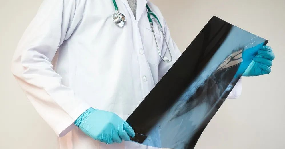 肺部结节 肺部结节