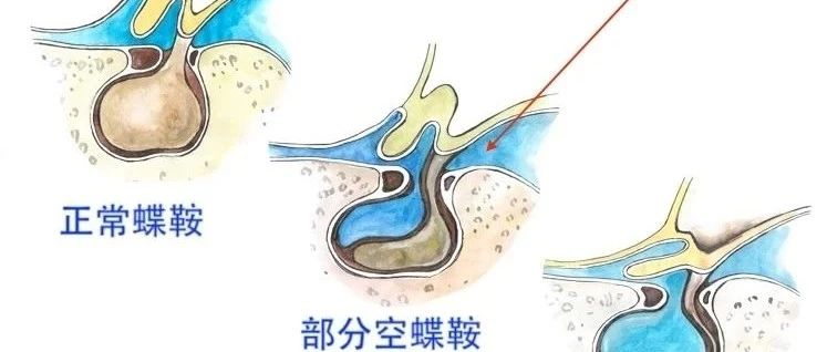 cover_image