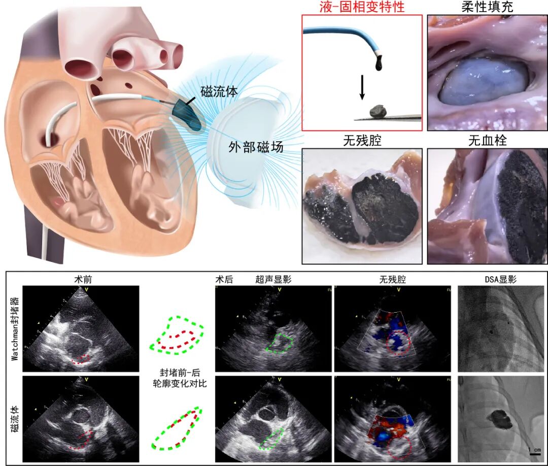 国家心血管病中心携手中科院在《Nature》发布磁流体封堵技术——宣告实现心脏在体3D打印梦想