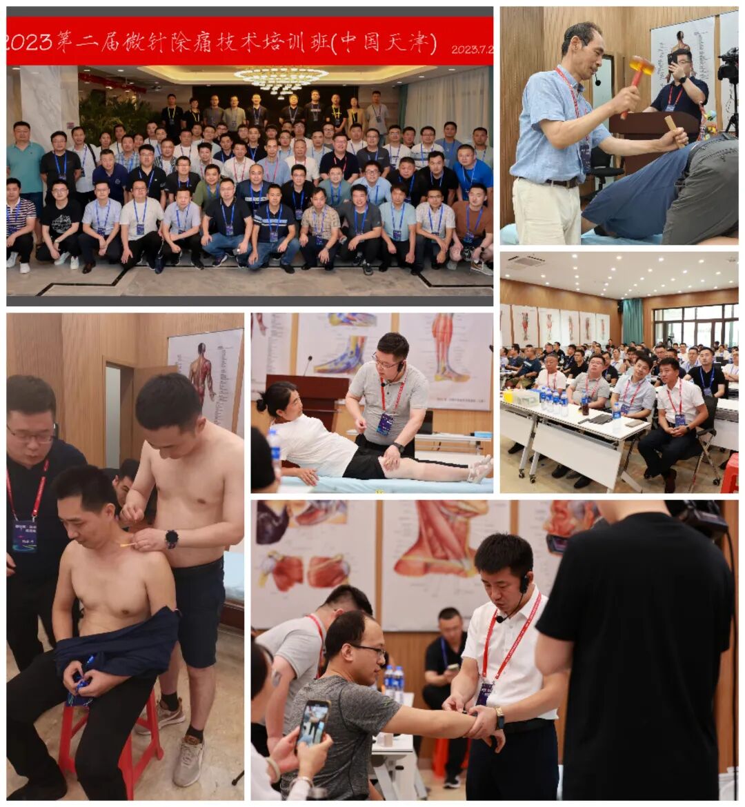 怎么取放射片研究--浅析下肢创伤中容易漏诊的X线片_https://www.jmylbn.com_新闻资讯_第35张