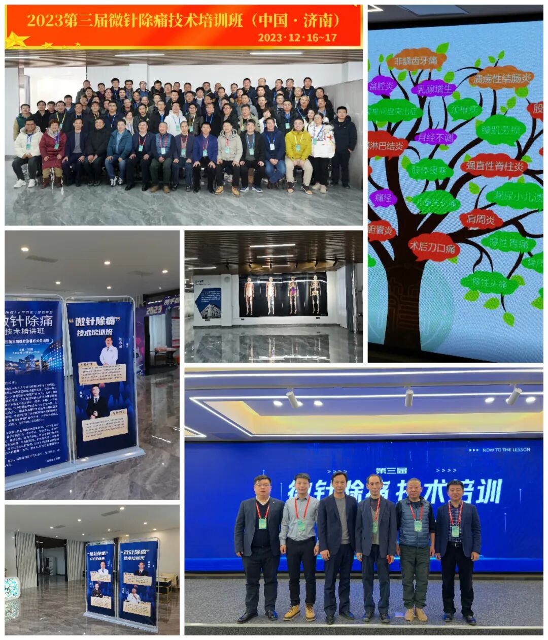 怎么取放射片研究--浅析下肢创伤中容易漏诊的X线片_https://www.jmylbn.com_新闻资讯_第32张