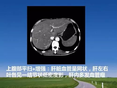 肝臟B超檢查結果常見術語解析 健康 第2張-尋夢健康 肝臟B超檢查結果常見術語解析 健康 第2張