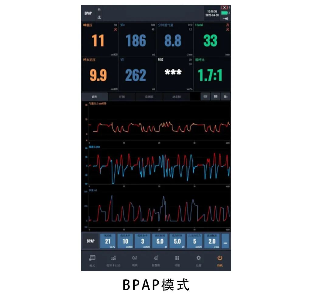 bipap是什么意思科普指南丨呼吸机BPAP模式在临床中的应用_https://www.jmylbn.com_新闻资讯_第7张