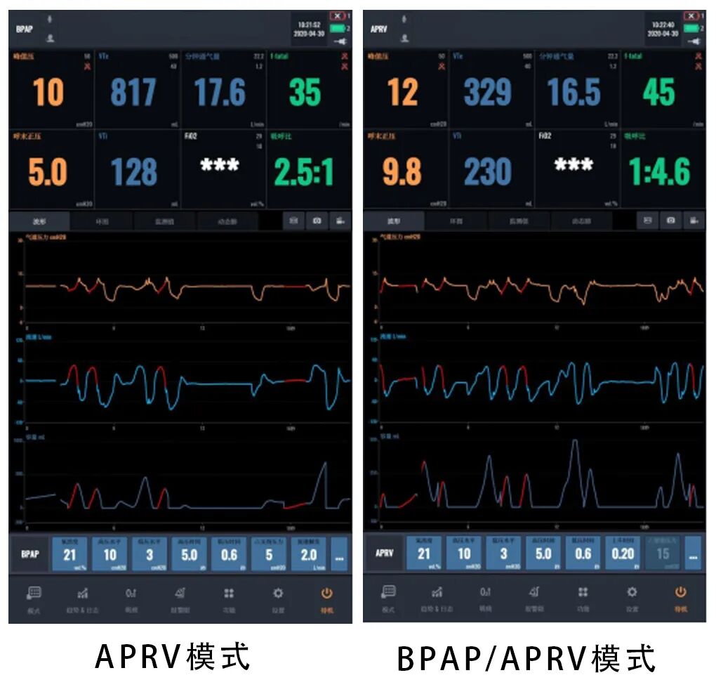 bipap是什么意思科普指南丨呼吸机BPAP模式在临床中的应用_https://www.jmylbn.com_新闻资讯_第8张