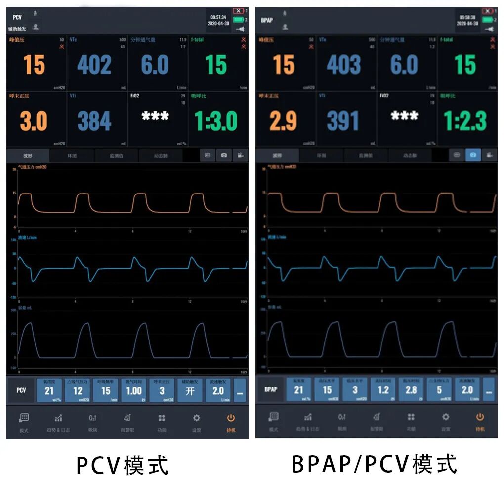 bipap是什么意思科普指南丨呼吸机BPAP模式在临床中的应用_https://www.jmylbn.com_新闻资讯_第5张