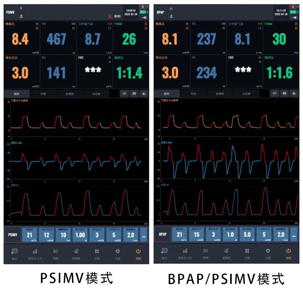 bipap是什么意思科普指南丨呼吸机BPAP模式在临床中的应用_https://www.jmylbn.com_新闻资讯_第6张