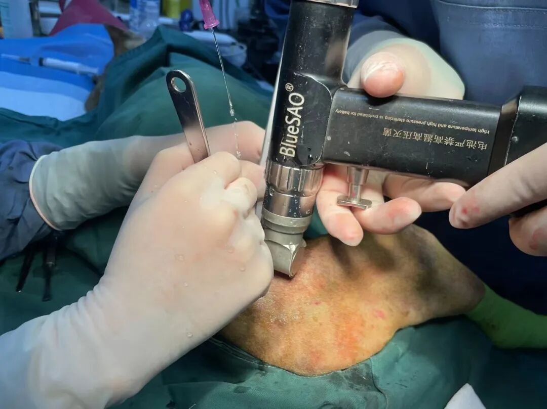 动物拍片腹部怎么摆【病例分享】犬-外科-股骨头切除术_https://www.jmylbn.com_新闻资讯_第24张