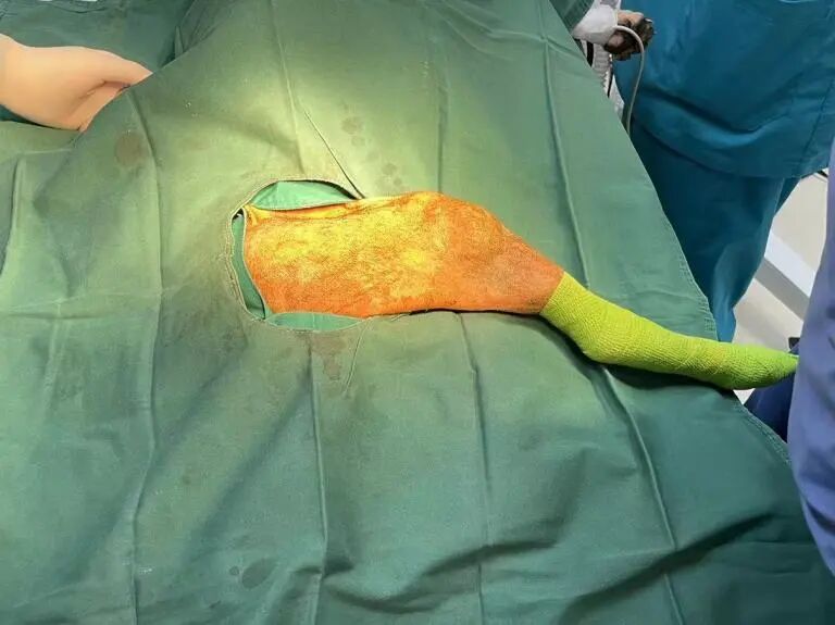 动物拍片腹部怎么摆【病例分享】犬-外科-股骨头切除术_https://www.jmylbn.com_新闻资讯_第16张