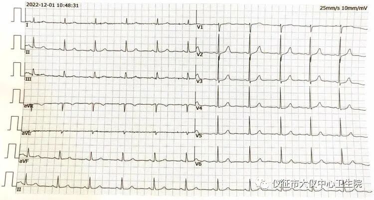 怎么装动态心电图健康从心开始----穿戴式动态心电图_https://www.jmylbn.com_新闻资讯_第1张