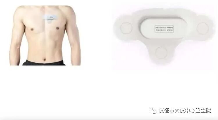怎么装动态心电图健康从心开始----穿戴式动态心电图_https://www.jmylbn.com_新闻资讯_第5张