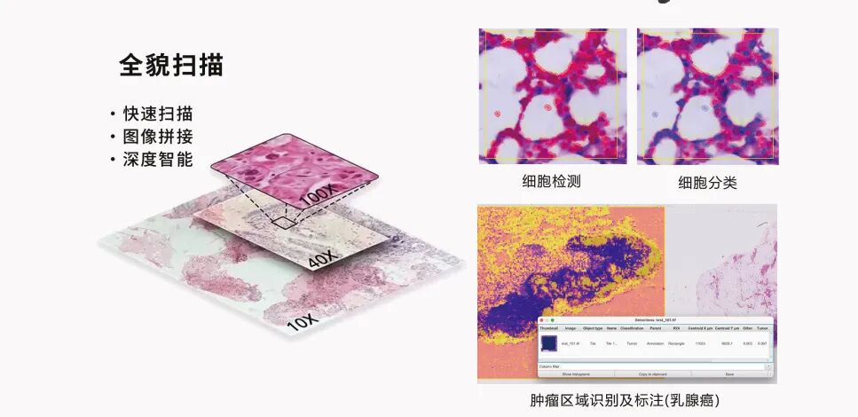 兰伯艾克斯丨数字扫描显微成像系统：精准洞察微观世界的利器