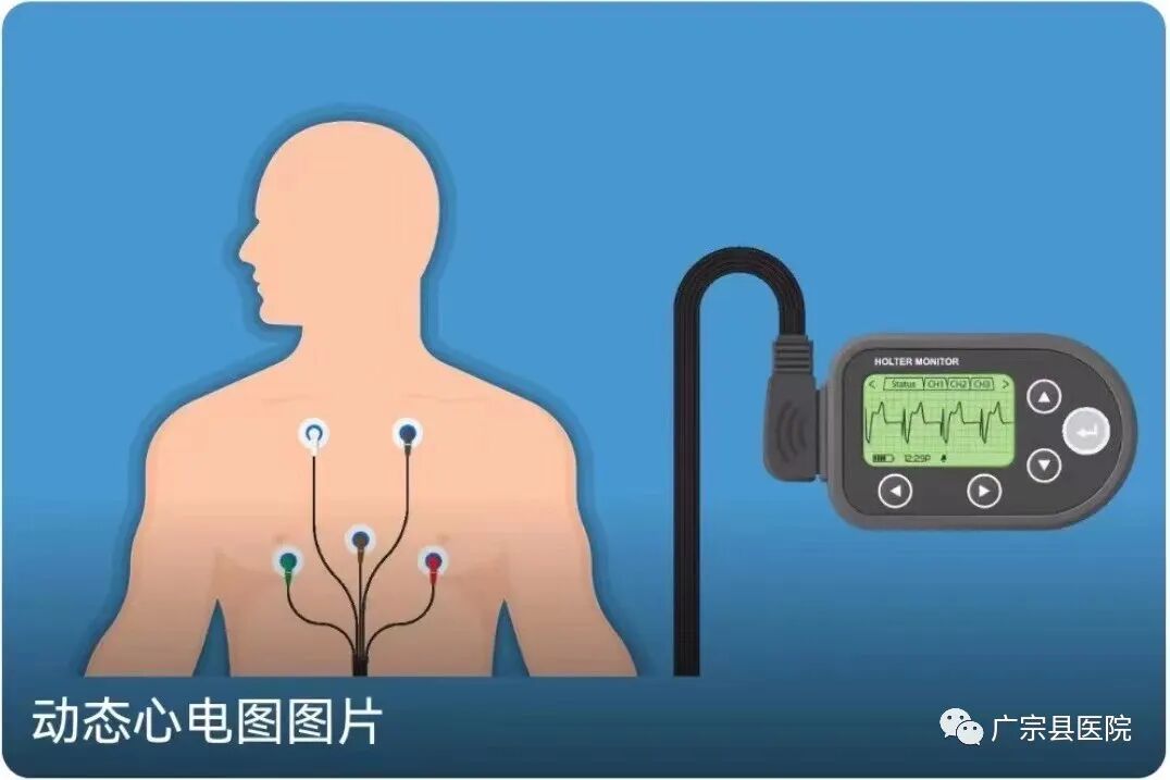 动态心电图接头怎么接小盒子，大智慧 —— 动态心电图知识普及_https://www.jmylbn.com_新闻资讯_第2张