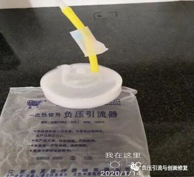 伤口负压治疗怎么收费致敬一名基层伤口专科护士，孤勇者里面的英雄，用纱布负压治愈胆漏_https://www.jmylbn.com_新闻资讯_第3张