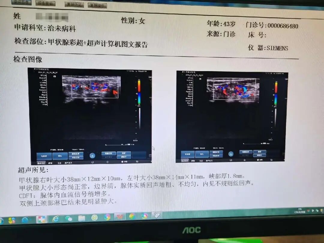 医用红外热像仪怎么开机零辐射，绿色体检－－红外热像检查，让中医可视化！_https://www.jmylbn.com_新闻资讯_第14张