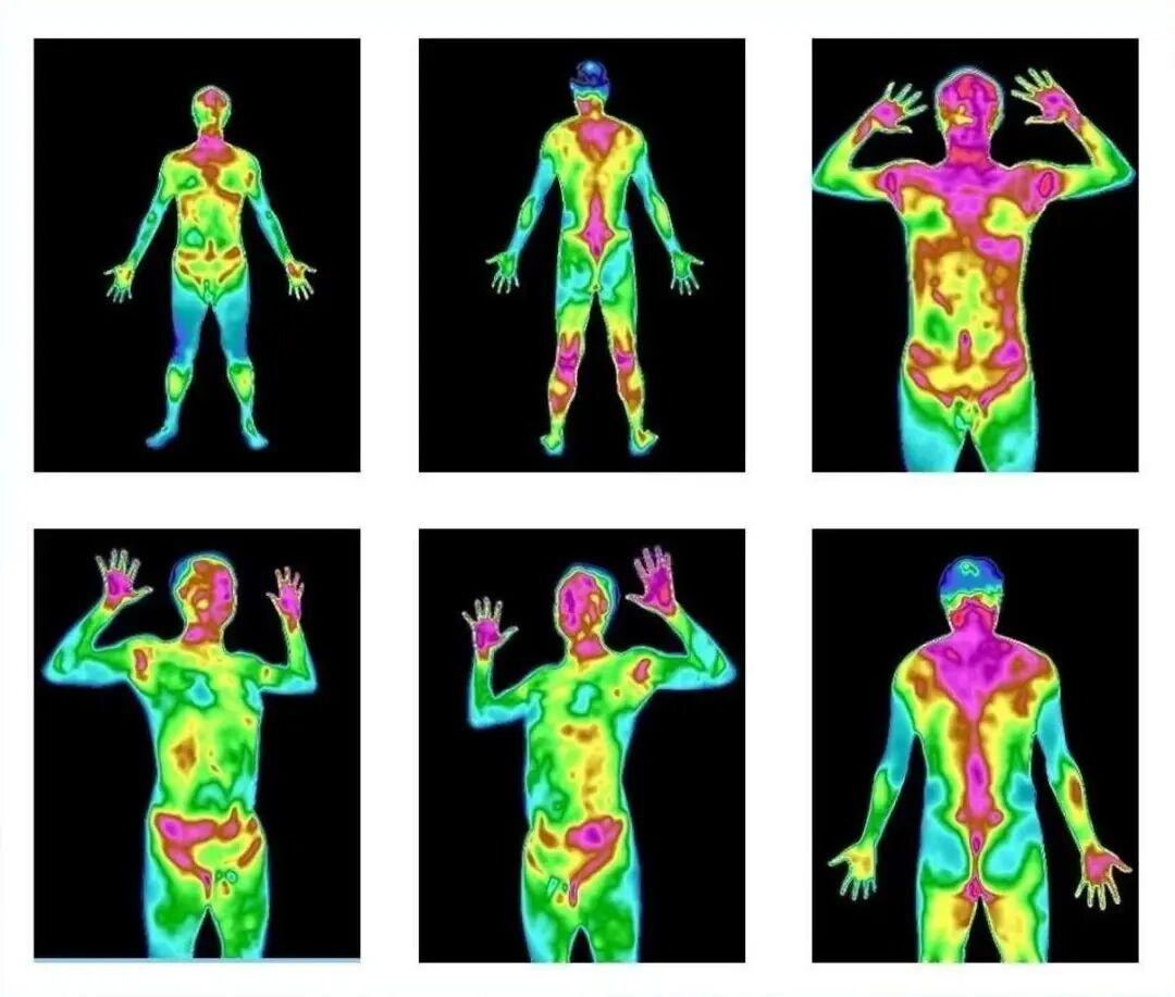 医用红外热像仪怎么开机零辐射，绿色体检－－红外热像检查，让中医可视化！_https://www.jmylbn.com_新闻资讯_第3张