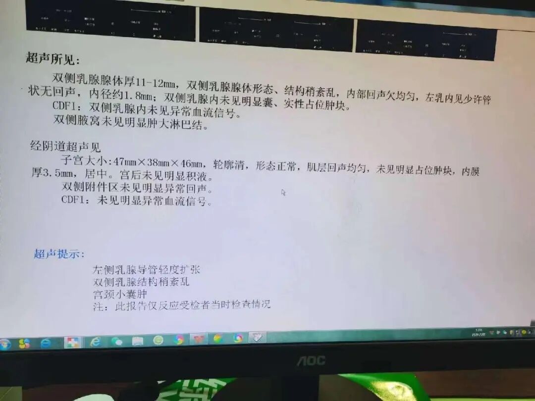 医用红外热像仪怎么开机零辐射，绿色体检－－红外热像检查，让中医可视化！_https://www.jmylbn.com_新闻资讯_第17张