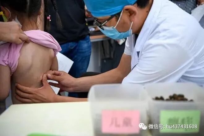 华佗怎么刮痧我国将大力推广中医适宜技术 使基层中医药服务基本全覆盖_https://www.jmylbn.com_新闻资讯_第1张