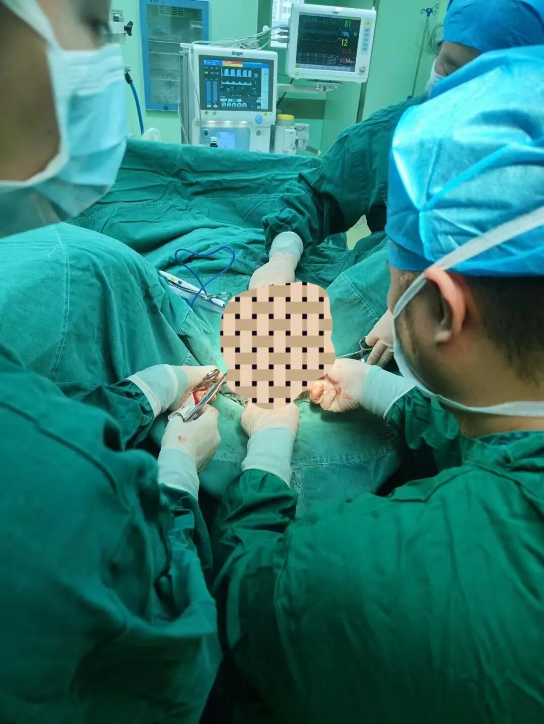 尿道张力过强怎么办【技术拓展】广南县中医医院妇产科开展经闭孔无张力尿道悬吊术（TVT-O），助尿失禁患者摆脱疾病困扰！_https://www.jmylbn.com_新闻资讯_第3张