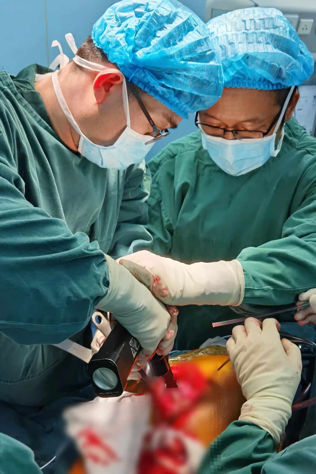 34张图文详解：21年融合髋THA的几点体会