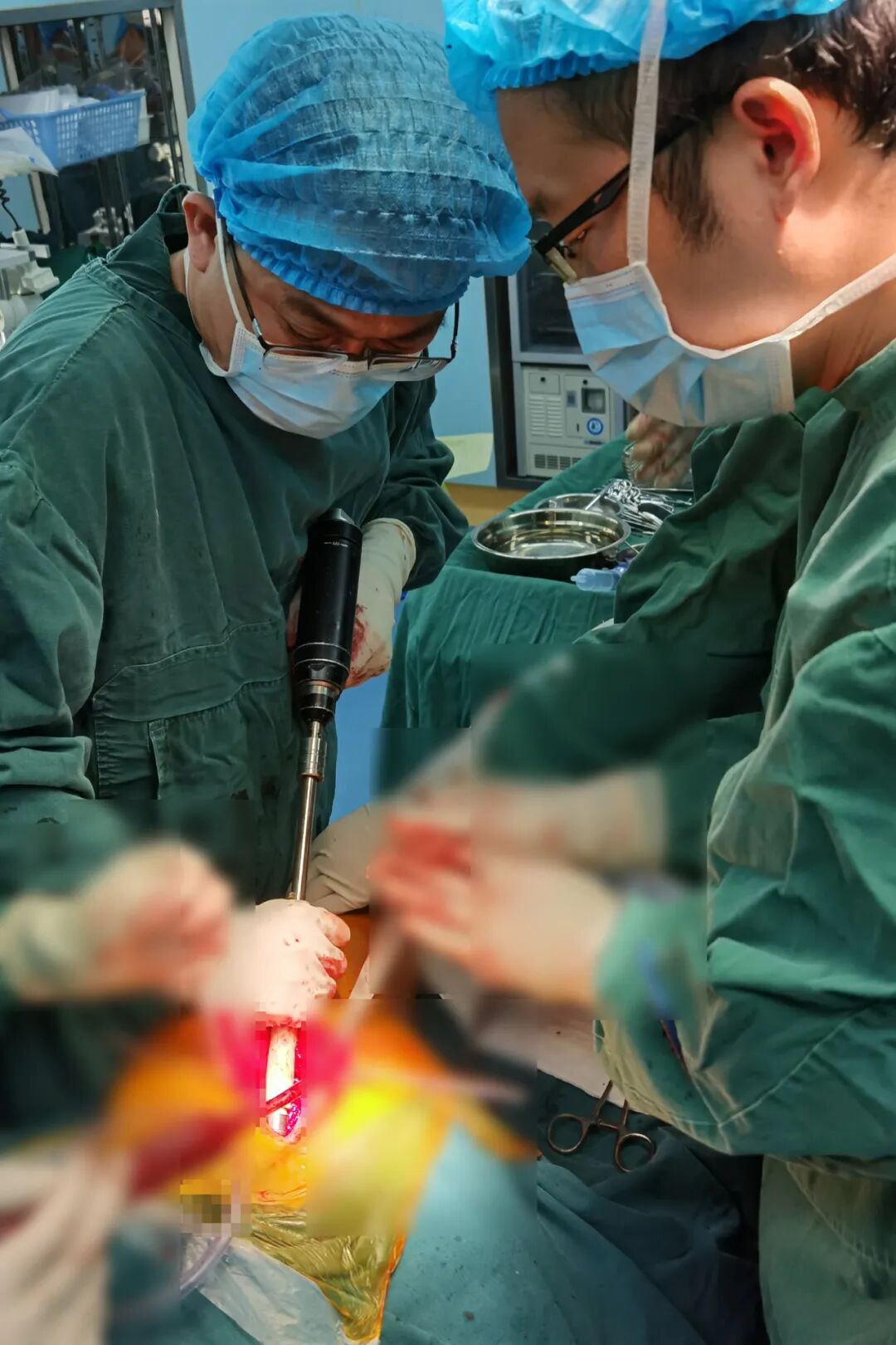 34张图文详解：21年融合髋THA的几点体会