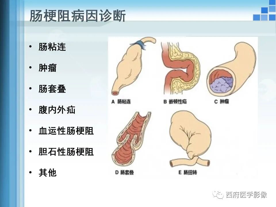 精确性的检查方法被广泛接受,更多用于临床体征症状较为复杂或矛盾