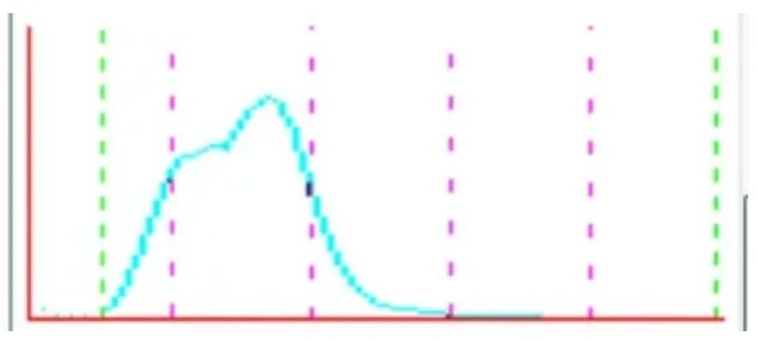 rbc直方图怎么看【安医科普】红细胞直方图解析_https://www.jmylbn.com_新闻资讯_第9张